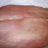 Rifondazione Ccomunista